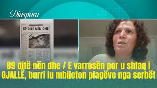 89 Ditë Nën Dhe E Varrosën Por U Shfaq I Gjallë, Burri Iu Mbijeton Plagëve Nga Serbët