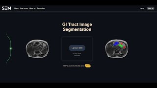 Medical Image Segmentation(Website)