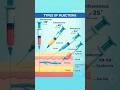 4 Types of Injections Explained | IM IV SC ID Injection Angles for DMLT