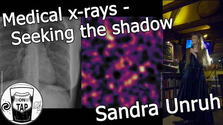Sandra Unruh, MSc - "Medical X-rays" - Astronomy o...