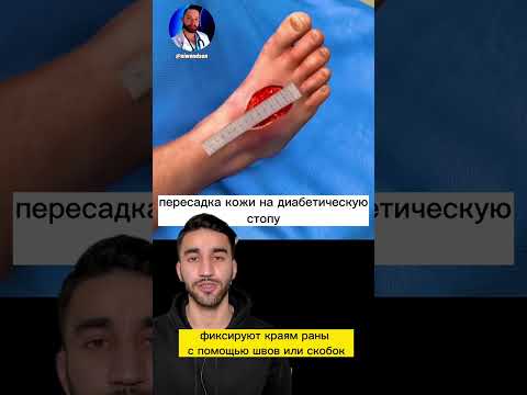 пересадка кожи