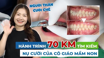THÁO MẮC CÀI NIỀNG RĂNG KẾT THÚC MỘT CHẶNG ĐƯỜNG DÀI VÀ KẾT QUẢ XỨNG ĐÁNG