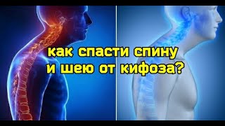 Грудной Кифоз Разрушает Шею, Спину, Сердце И Лёгкие. Методы Исправления