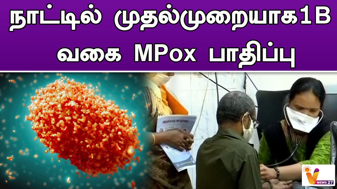 நாட்டில் முதல்முறையாக1B வகை MPox பாதிப்பு | MPOX | 1B Virus | Kerala