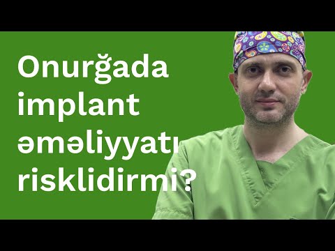 Onurğasına implant yerləşdirildi, \