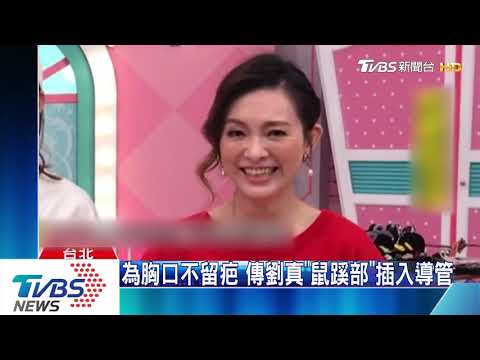 劉真裝「人工肺」續命？　醫：若狀況差、氧合不足