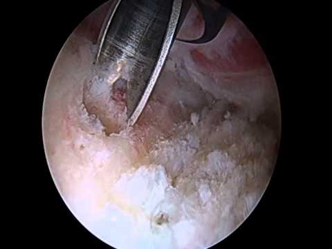 Sutura labrum camera iphone 8 plus apk