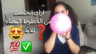 ازاى اتخلصت من الخطوط البيضاء للابد؟  وصفه سحريه