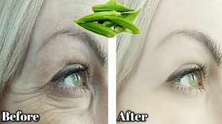 An ingredient, a million times stronger than botox Apply it to your face, and get rid of wrinkles