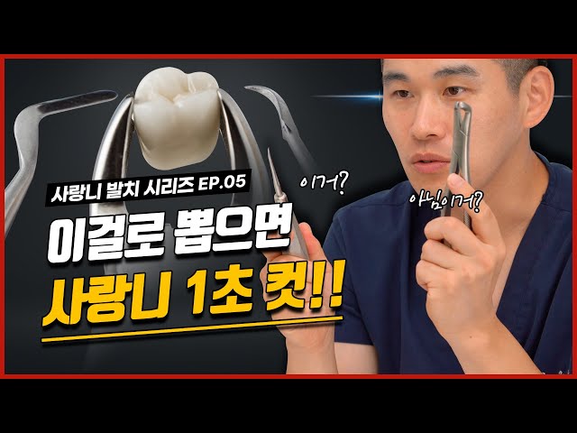 사랑니 발치! 이 도구로 결정 납니다 | 사랑니 발치 도구,  사랑니 발치