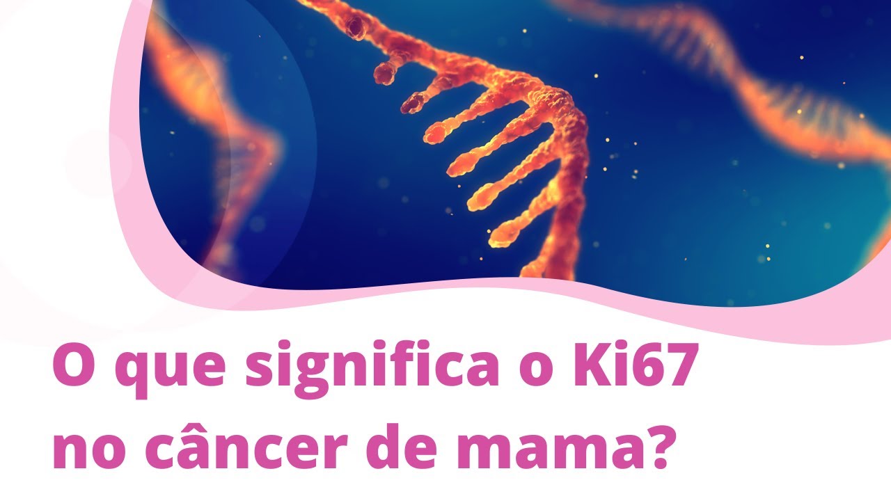 Últimas Que Es Ki67 En Cancer De Mama