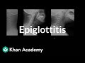 Epiglottitis diagnosis and treatment | Respiratory system diseases | NCLEX-RN | Khan Academy