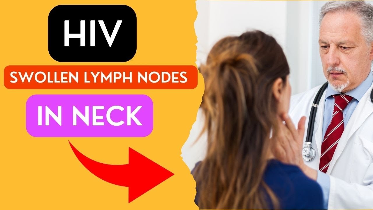 Hiv Swollen Lymph Nodes In Neck Youtube