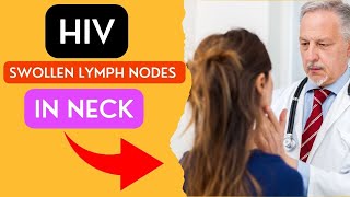 HIV Swollen Lymph Nodes in Neck