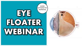 FLOATERS IN MY EYES: youtube eye doctor webinar on eye flashes \& floaters