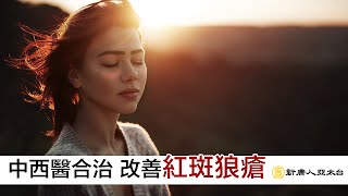 中西醫合治 改善『紅斑狼瘡』| 談古論今話中醫(517)