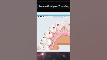 Maestro 3D | Dental Studio Expert | Automatic aligner trimming