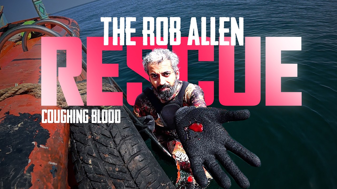 I Coughed Up Blood Saving My Rob Allen!