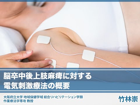 【電気刺激療法シリーズ①】脳卒中後上肢麻痺に対する電気刺激療法の概要