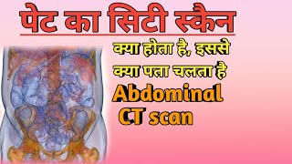 पेट का सिटी स्कैन क्यों और कैसे किया जाता है? || Abdominal CT scan in Hindi || MedHealth Support screenshot 1