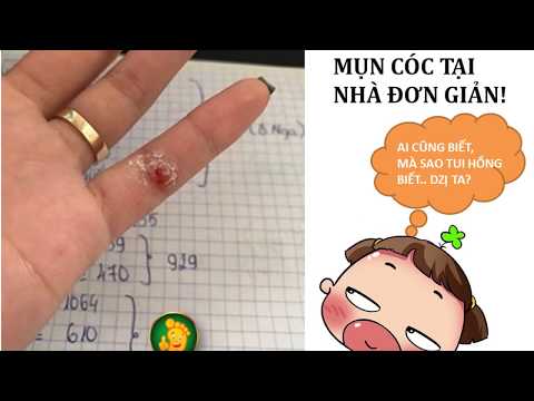 Video Hướng dẫn sử dụng miếng dán plasters chữa mụn cóc mắt... - youtube