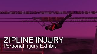 Zipline Injury