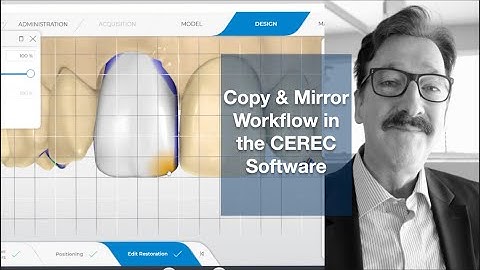 Copy & Mirror Workflow in the CEREC Software