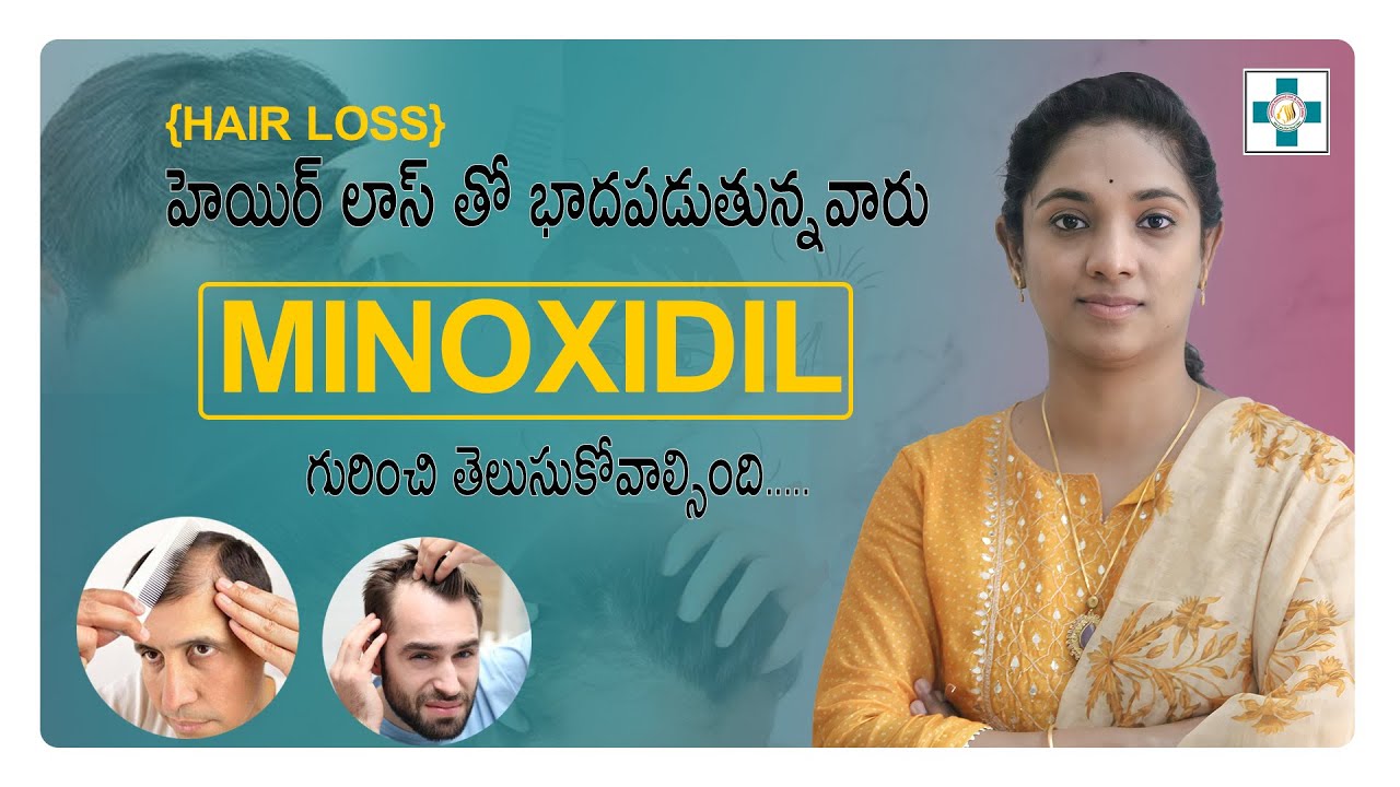 హెయిర్ లాస్ తో భాదపడుతున్నవారు #minoxidil  గురించి తెలుసుకోవాల్సింది| Minoxidil | Hair loss Solution