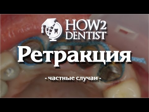 Как выполнить ретракцию при поддесневом и придесневом препарировании / How to Dentist