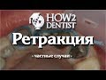 Как выполнить ретракцию при поддесневом и придесневом препарировании / How to Dentist