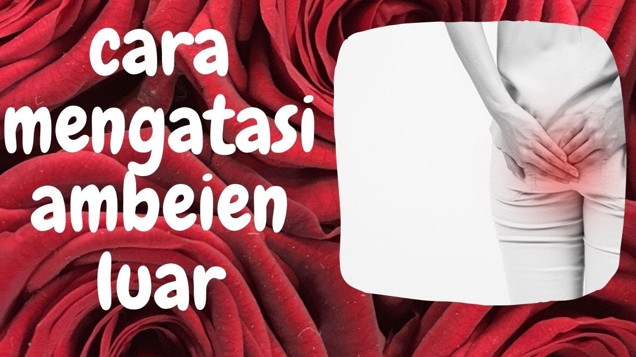 cara mengatasi ambeien luar