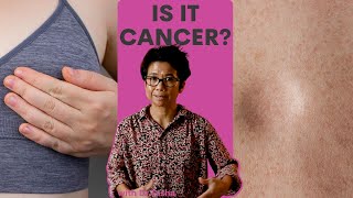 Are All Breast Lumps Cancer? With Dr Tasha