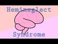 When An Injured Brain Ignores Half The World | Hemineglect Syndrome