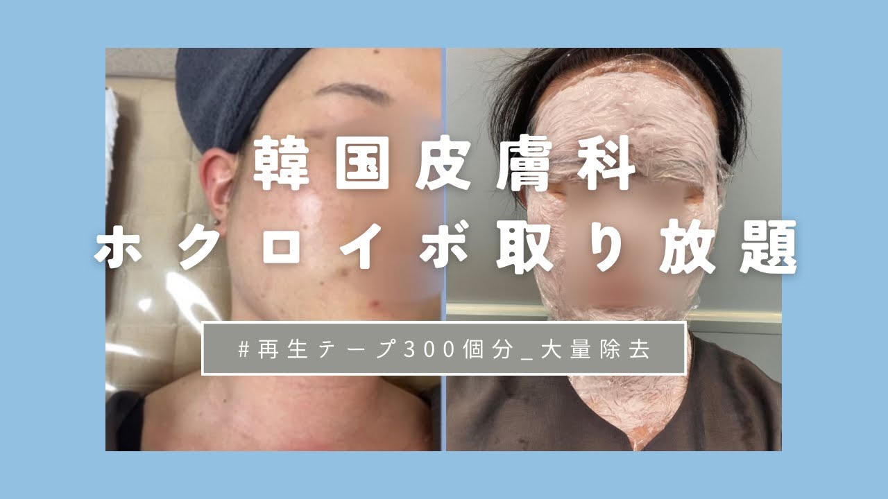 リメイ皮膚科 | ホクロとイボ取り放題レポ | 当日から3カ月後まで | ケア用品紹介