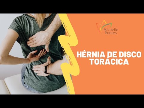 Vídeo: Hérnia Da Coluna Torácica: Sintomas, Tratamento, Causas