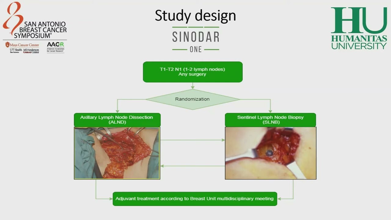 SABCS 2021: Preservation of axillary lymph nodes compared to complete dissection in T1-T2 cancer