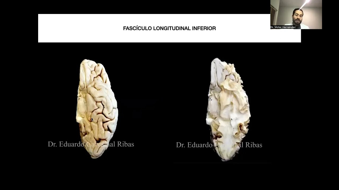 Clase 4 Anatomía de fibras blancas