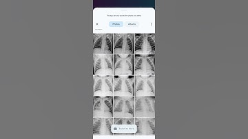 MTP Project Demo | Federated Learning for Detecting Pneumonia
