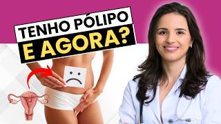 CIRURGIA DE PÓLIPO NO ÚTERO: TEM CORTE? DÓI? GUIA COMPLETO | DRA. CAMILA BONACORDI