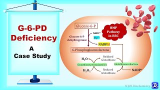 19: G6PD deficiency- A case Study | Carbohydrate Metabolism | Biochemistry | N'JOY Biochemistry screenshot 4