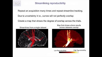 44. Diffusion Tractography: Probabilistic Tractography: PROBTRACKX (Tract E3)