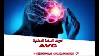 cardiologue Casablanca - Dr Driss Benchakroune - AVC