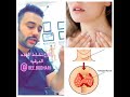 علاج الغده الدرقيه النشطه