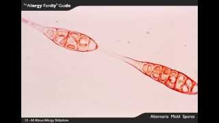 All About Allergy Slideshow - Alternaria Mold Spores, 13 Of 29