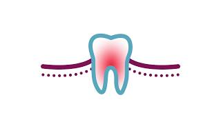 Emergency Dental Treatment For Toothache Relief