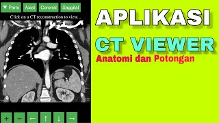Aplikasi CT scan view //bisa untuk belajar anatomi dari hasil CT scan//Radiology screenshot 3