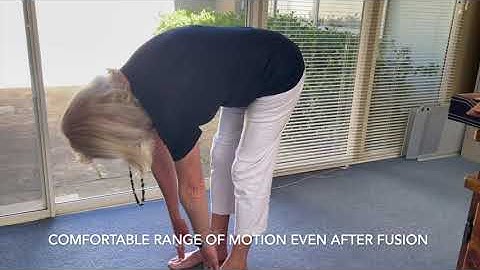 Front-back "360-degree" reconstruction and delightful range of motion