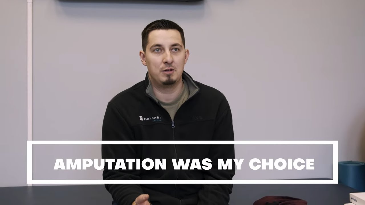 Amputation Was My Choice | My Amputee Journey | When you are tired of living in pain