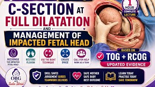 Full Impacted Fetal Head at Caesarean Section | C-Section at Full Dilatation | RCOG + TOG | Labour Lec 9 News
