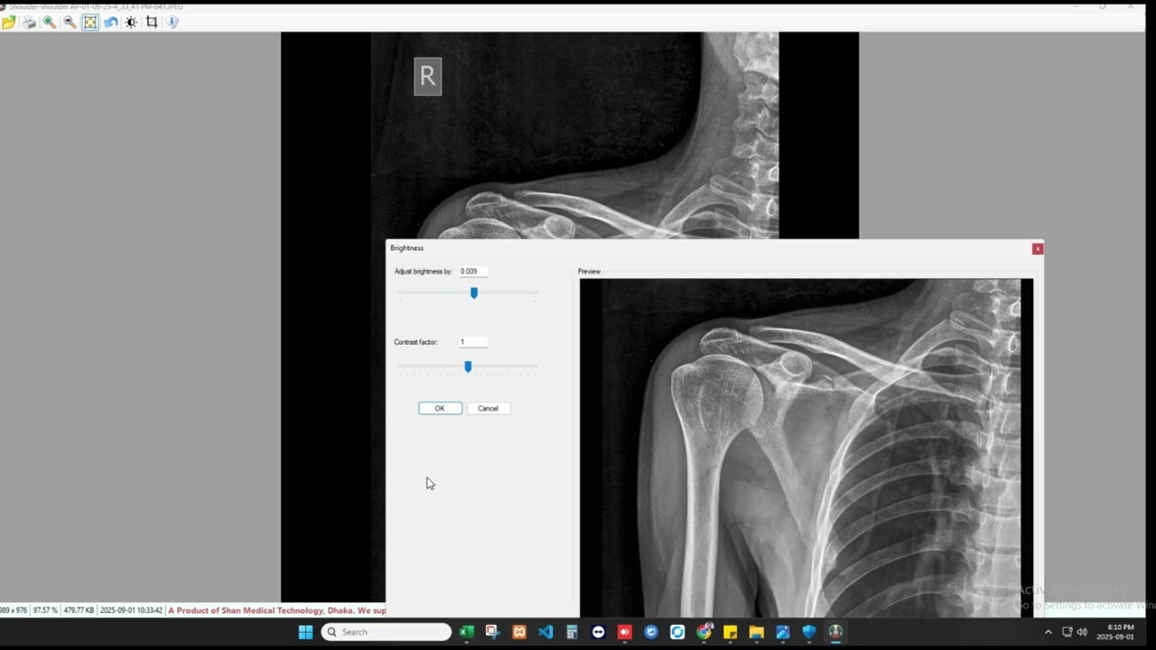 X-ray image (jpg) printing by our Dicom Software, Epson Printer and our inkjet film.